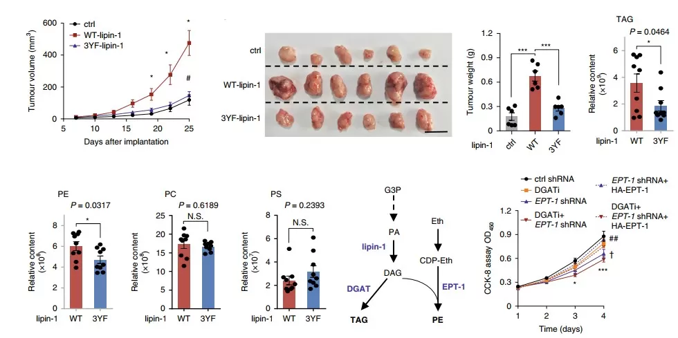The proliferation of breast cancer cells depends on the tyrosine phosphorylation of lipin-1